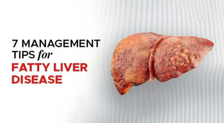 What You Need to Know About Fatty Liver Disease and How to Prevent It